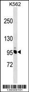 Non-SMC Condensin I Complex Subunit H antibody, 60-139, ProSci, Western Blot image 