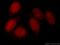 DNA Methyltransferase 1 antibody, 24206-1-AP, Proteintech Group, Immunofluorescence image 