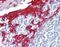 Keratin 13 antibody, NBP1-06047, Novus Biologicals, Immunohistochemistry paraffin image 