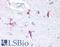 Fascin Actin-Bundling Protein 1 antibody, LS-B16149, Lifespan Biosciences, Immunohistochemistry paraffin image 