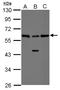 RAD23 Homolog B, Nucleotide Excision Repair Protein antibody, LS-C155358, Lifespan Biosciences, Western Blot image 