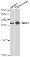 Nucleolar Protein 3 antibody, A14082, ABclonal Technology, Western Blot image 