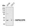 Death Associated Protein Kinase 3 antibody, PA5-17118, Invitrogen Antibodies, Western Blot image 