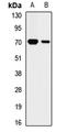 Keratin 2 antibody, LS-C667875, Lifespan Biosciences, Western Blot image 