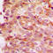 Collagen Type IV Alpha 1 Chain antibody, LS-C352029, Lifespan Biosciences, Immunohistochemistry paraffin image 