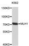 MutL Homolog 1 antibody, STJ24564, St John