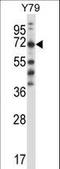 Phenylalanyl-TRNA Synthetase Subunit Beta antibody, LS-C166049, Lifespan Biosciences, Western Blot image 