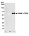 CD226 Molecule antibody, A304-362A, Bethyl Labs, Western Blot image 