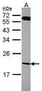 Regulator Of G Protein Signaling 10 antibody, LS-C186385, Lifespan Biosciences, Western Blot image 