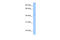 SET Domain Containing 7, Histone Lysine Methyltransferase antibody, 30-476, ProSci, Enzyme Linked Immunosorbent Assay image 