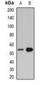 Perilipin 2 antibody, abx142147, Abbexa, Western Blot image 