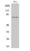 Interleukin 1 Receptor Associated Kinase 1 antibody, STJ93756, St John