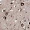 Endoplasmic Reticulum Protein 29 antibody, NBP1-88396, Novus Biologicals, Immunohistochemistry paraffin image 