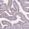 Dynein Regulatory Complex Subunit 3 antibody, PA5-57505, Invitrogen Antibodies, Immunohistochemistry frozen image 
