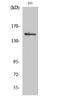 Mitogen-Activated Protein Kinase Kinase Kinase 5 antibody, A00929S966-2, Boster Biological Technology, Western Blot image 