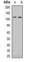 RB Transcriptional Corepressor 1 antibody, orb338868, Biorbyt, Western Blot image 