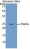 Interferon Alpha And Beta Receptor Subunit 1 antibody, LS-C292457, Lifespan Biosciences, Western Blot image 