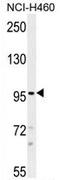 Transient Receptor Potential Cation Channel Subfamily M Member 8 antibody, AP54365PU-N, Origene, Western Blot image 