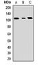 Phosphoribosylglycinamide Formyltransferase, Phosphoribosylglycinamide Synthetase, Phosphoribosylaminoimidazole Synthetase antibody, LS-C667963, Lifespan Biosciences, Western Blot image 