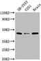 Leucine Rich Repeats And Transmembrane Domains 2 antibody, CSB-PA847660LA01HU, Cusabio, Western Blot image 