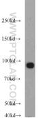 Nuclear Receptor Subfamily 3 Group C Member 1 antibody, 24050-1-AP, Proteintech Group, Western Blot image 