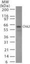 Checkpoint Kinase 2 antibody, NBP2-27403, Novus Biologicals, Western Blot image 