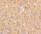 Lysyl Oxidase Like 2 antibody, NBP2-75559, Novus Biologicals, Immunohistochemistry paraffin image 