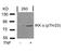 Component Of Inhibitor Of Nuclear Factor Kappa B Kinase Complex antibody, 79-161, ProSci, Western Blot image 