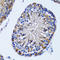 Inositol monophosphatase 1 antibody, LS-C334674, Lifespan Biosciences, Immunohistochemistry paraffin image 