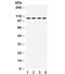 Nuclear Receptor Subfamily 3 Group C Member 2 antibody, R31912, NSJ Bioreagents, Western Blot image 