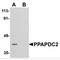 Phospholipid Phosphatase 6 antibody, MBS150238, MyBioSource, Western Blot image 