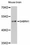 Gamma-Aminobutyric Acid Type A Receptor Alpha1 Subunit antibody, LS-C747395, Lifespan Biosciences, Western Blot image 