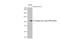 Dengue virus antibody, GTX629447, GeneTex, Western Blot image 