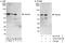 Sterile Alpha Motif Domain Containing 1 antibody, A303-578A, Bethyl Labs, Immunoprecipitation image 
