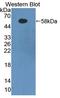 Fibrinogen Beta Chain antibody, LS-C304070, Lifespan Biosciences, Western Blot image 