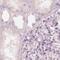 Keratin, type II cuticular Hb2 antibody, PA5-63605, Invitrogen Antibodies, Immunohistochemistry frozen image 