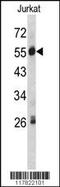 Plasma protease C1 inhibitor antibody, 62-392, ProSci, Western Blot image 