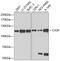 Calcium/Calmodulin Dependent Serine Protein Kinase antibody, GTX53920, GeneTex, Western Blot image 