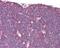 LCK Proto-Oncogene, Src Family Tyrosine Kinase antibody, GTX107432, GeneTex, Immunohistochemistry paraffin image 