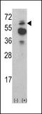 Activated CDC42 kinase 1 antibody, LS-C155932, Lifespan Biosciences, Western Blot image 