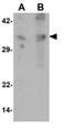 Glutamate Ionotropic Receptor NMDA Type Subunit Associated Protein 1 antibody, GTX17187, GeneTex, Western Blot image 