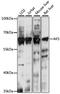 Adenylate Kinase 5 antibody, A11378-1, Boster Biological Technology, Western Blot image 