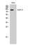 Non-SMC Condensin I Complex Subunit H antibody, STJ93471, St John