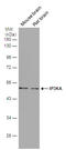 Inositol-Trisphosphate 3-Kinase A antibody, GTX111539, GeneTex, Western Blot image 