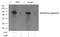 Protein Kinase D1 antibody, GTX50160, GeneTex, Western Blot image 