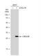 C-X-C Motif Chemokine Ligand 16 antibody, NBP2-16042, Novus Biologicals, Western Blot image 