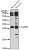 Epididymal Sperm Binding Protein 1 antibody, 16-296, ProSci, Western Blot image 