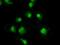 TYRO3 Protein Tyrosine Kinase antibody, GTX83458, GeneTex, Immunofluorescence image 