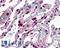 ELOVL Fatty Acid Elongase 5 antibody, LS-A9855, Lifespan Biosciences, Immunohistochemistry paraffin image 