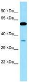 VPS33A Core Subunit Of CORVET And HOPS Complexes antibody, TA343192, Origene, Western Blot image 